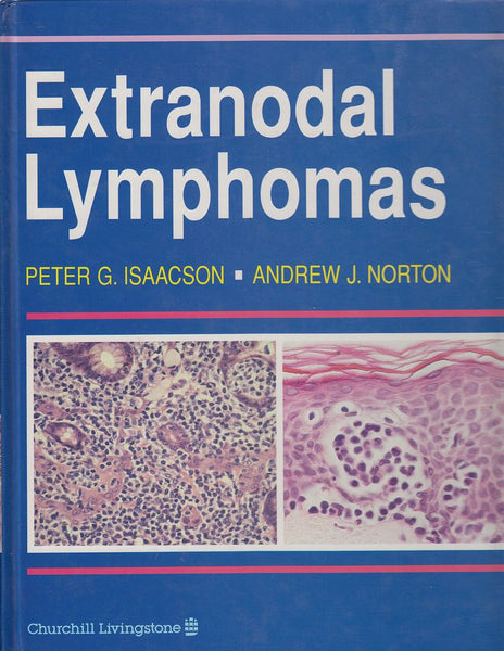 Extranodal Lymphomas, 1e